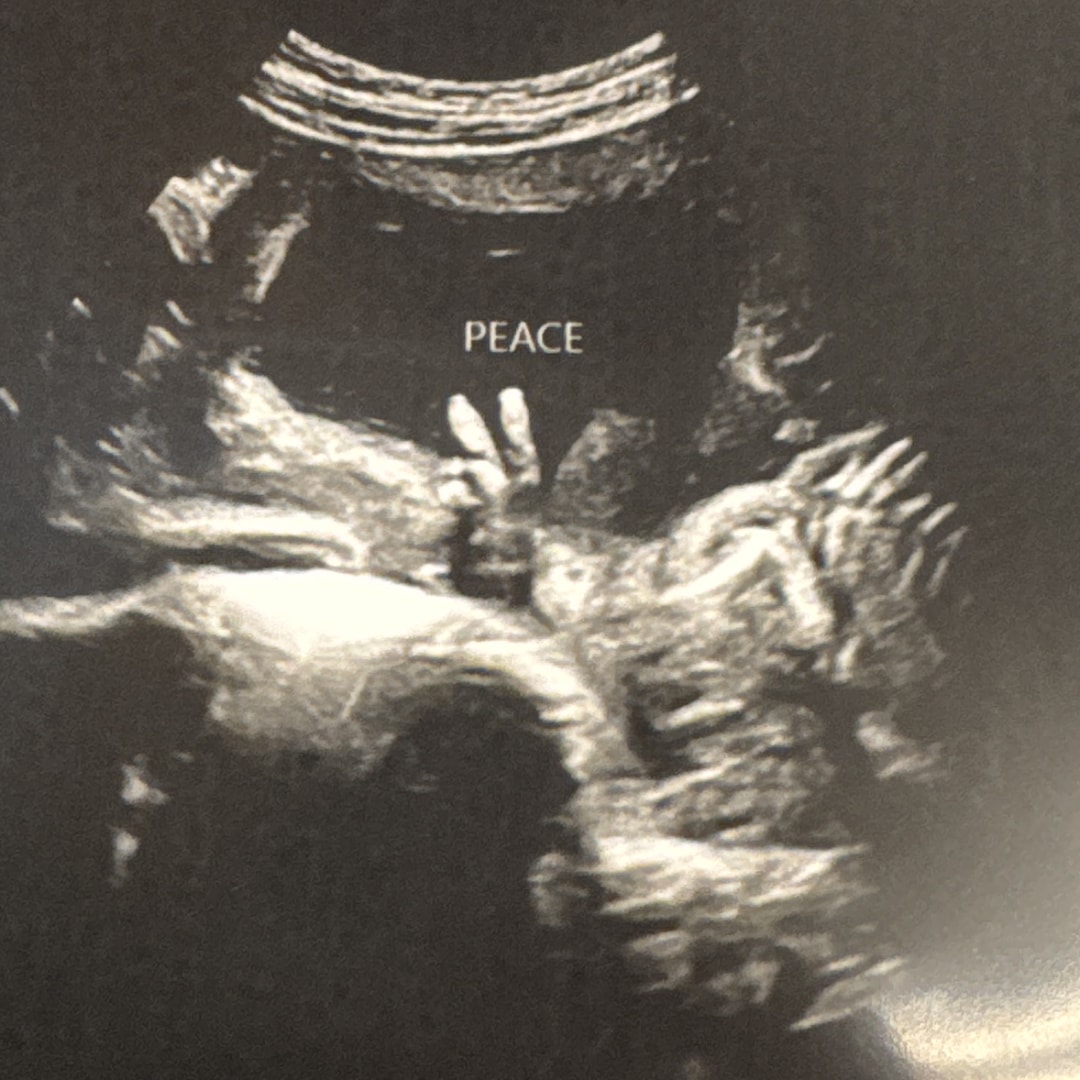 Photo shared by Rachel for their Babylist baby registry.
