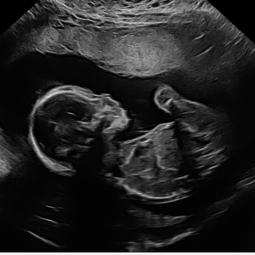 Photo shared by Kristin for their Babylist baby registry.