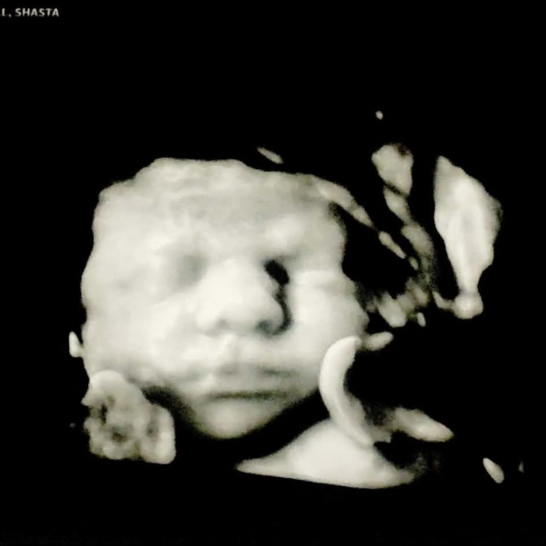 Photo shared by Shasta for their Babylist baby registry.