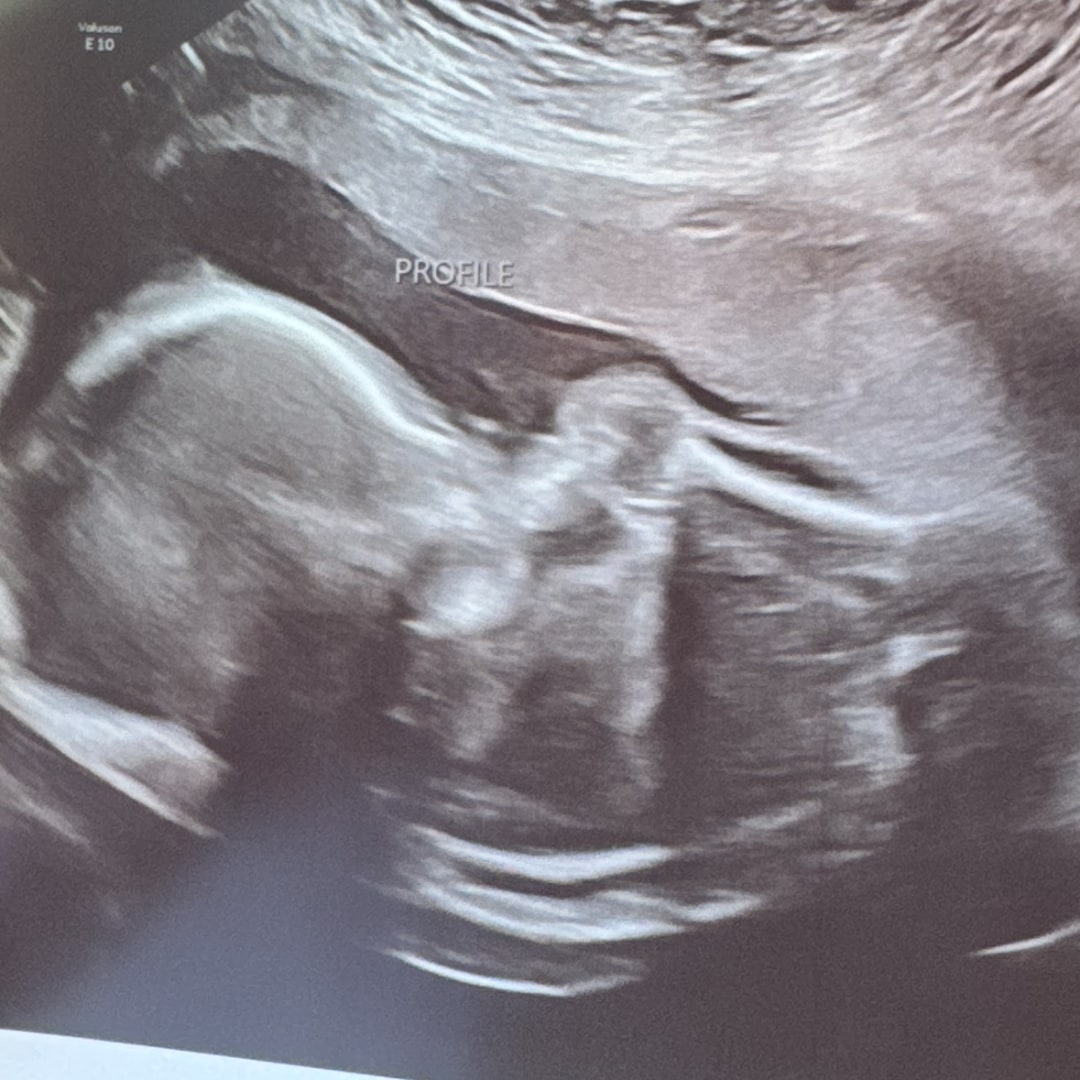 Photo shared by Michelle for their Babylist baby registry.