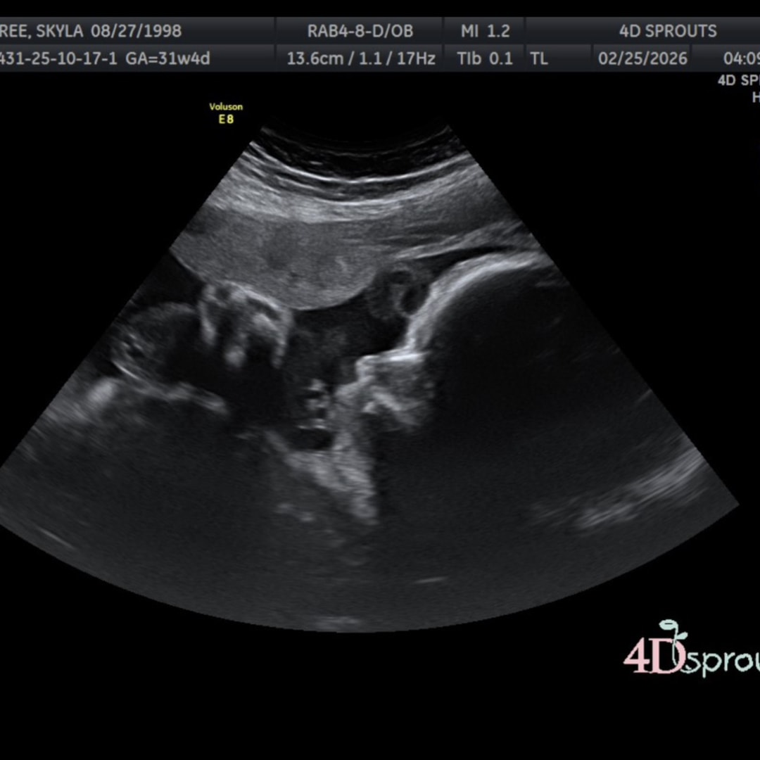 Photo shared by Skyla for their Babylist baby registry.