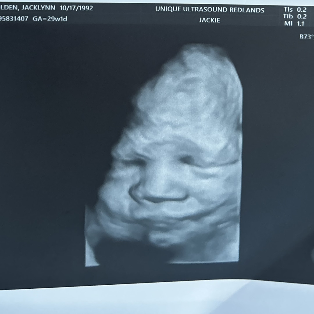 Photo shared by Jacklynn & Michael for their Babylist baby registry.