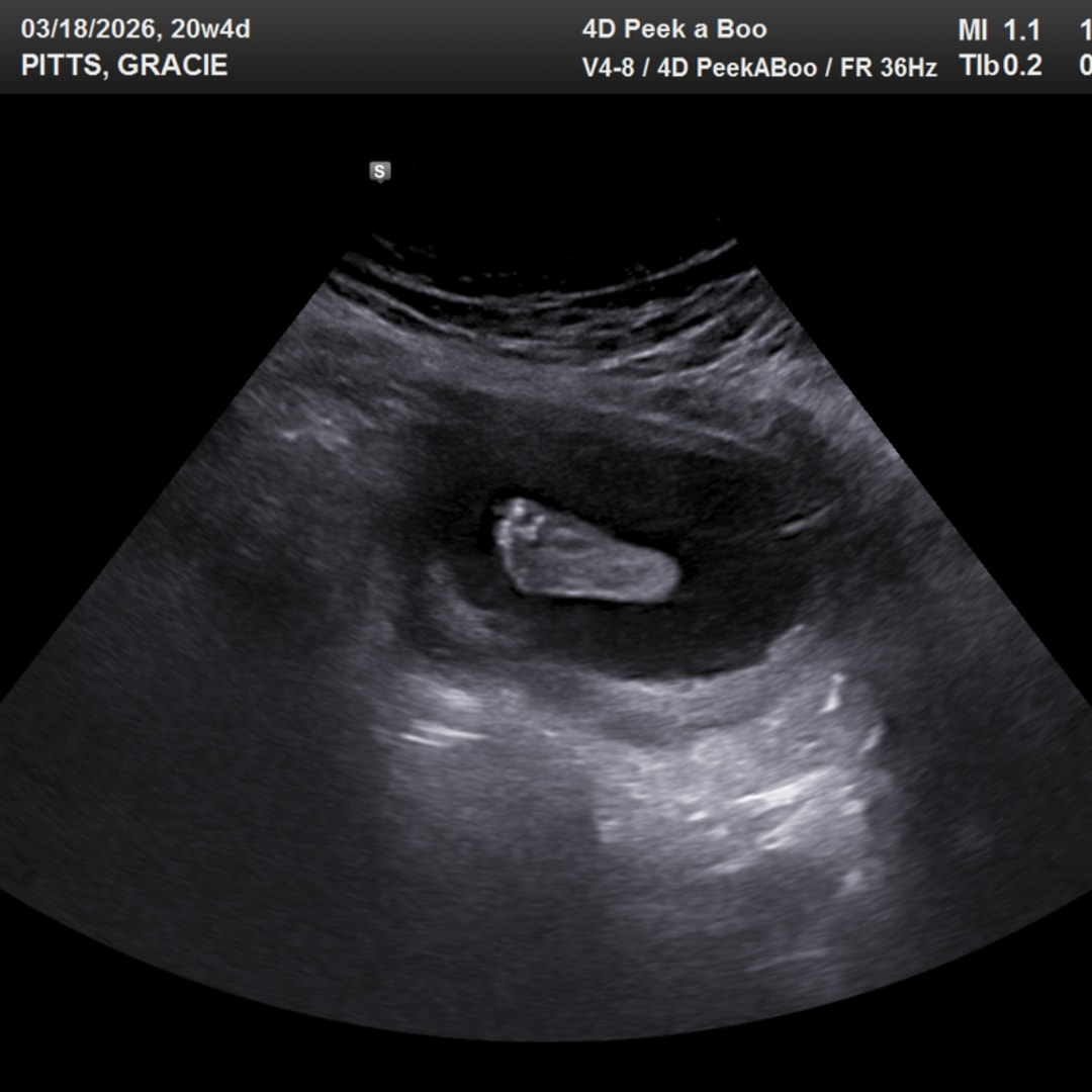 Photo shared by Gracie for their Babylist baby registry.