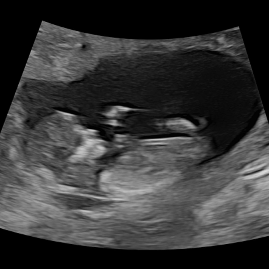 Photo shared by Kaitlyn for their Babylist baby registry.