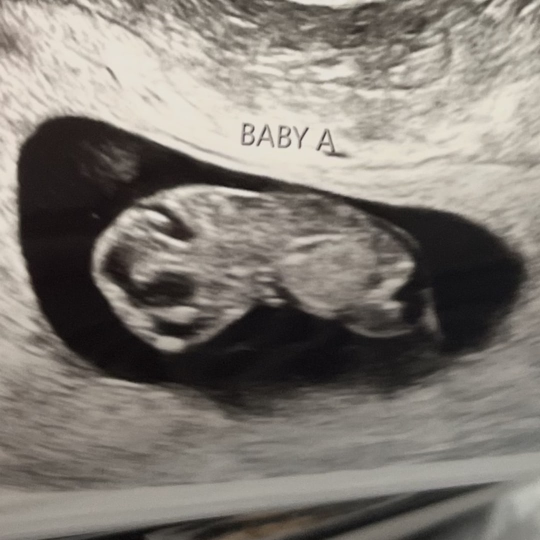Photo shared by Kara for their Babylist baby registry.