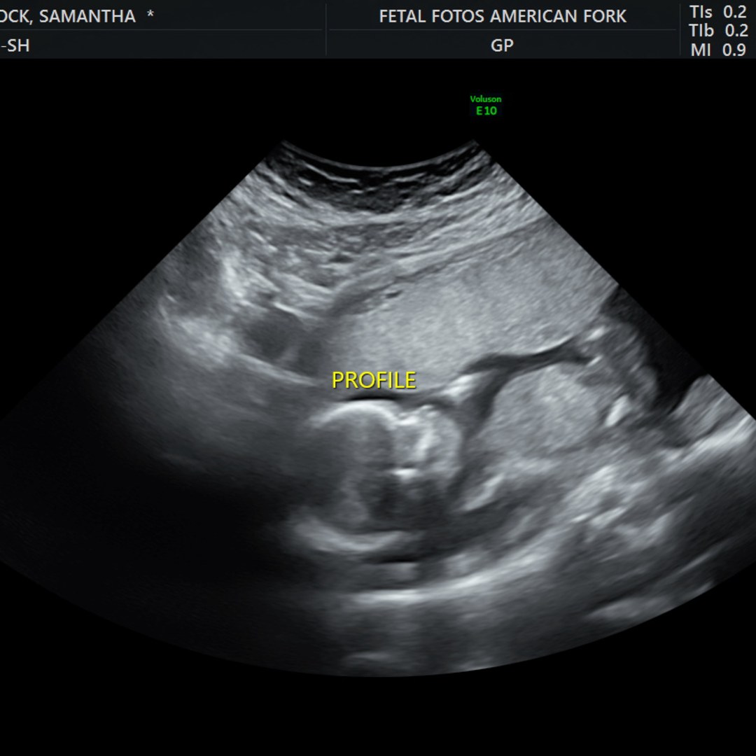 Photo shared by Samantha for their Babylist baby registry.