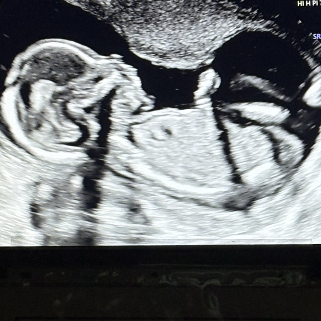 Photo shared by Jenna for their Babylist baby registry.