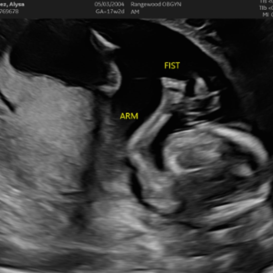 Photo shared by Alysa for their Babylist baby registry.