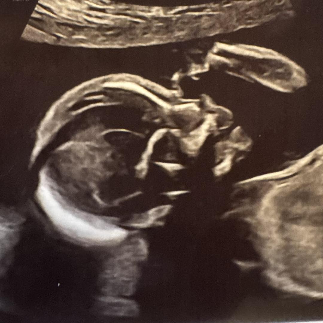 Photo shared by Meredith for their Babylist baby registry.