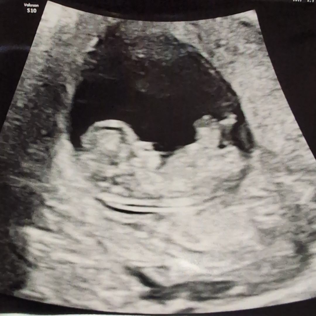 Photo shared by Isabelle for their Babylist baby registry.