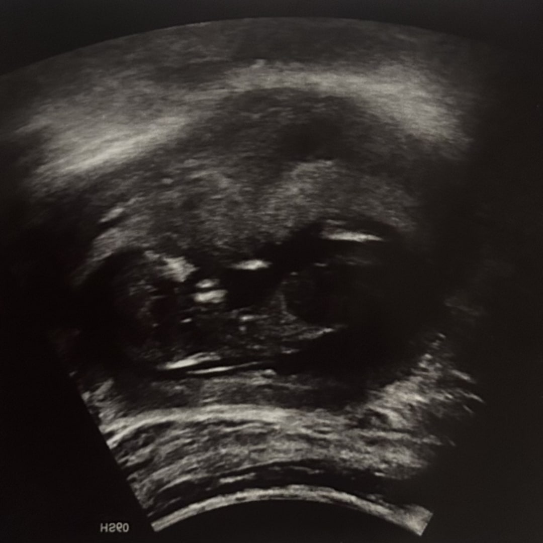 Photo shared by Ashlyn for their Babylist baby registry.