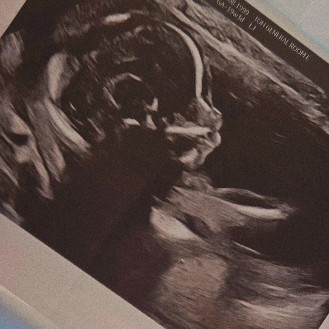 Photo shared by Emily for their Babylist baby registry.