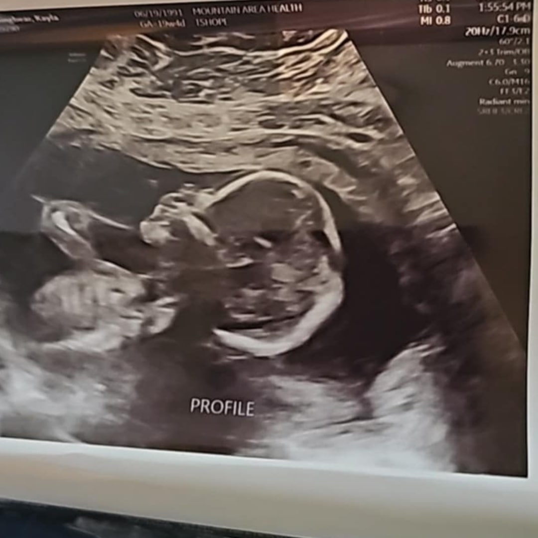 Photo shared by Kayla for their Babylist baby registry.