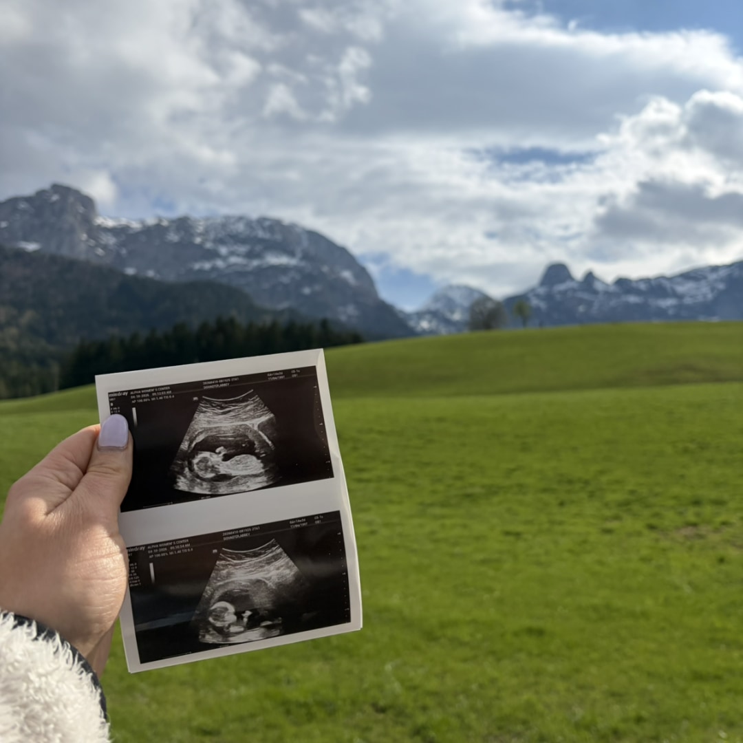 Photo shared by Abbey for their Babylist baby registry.