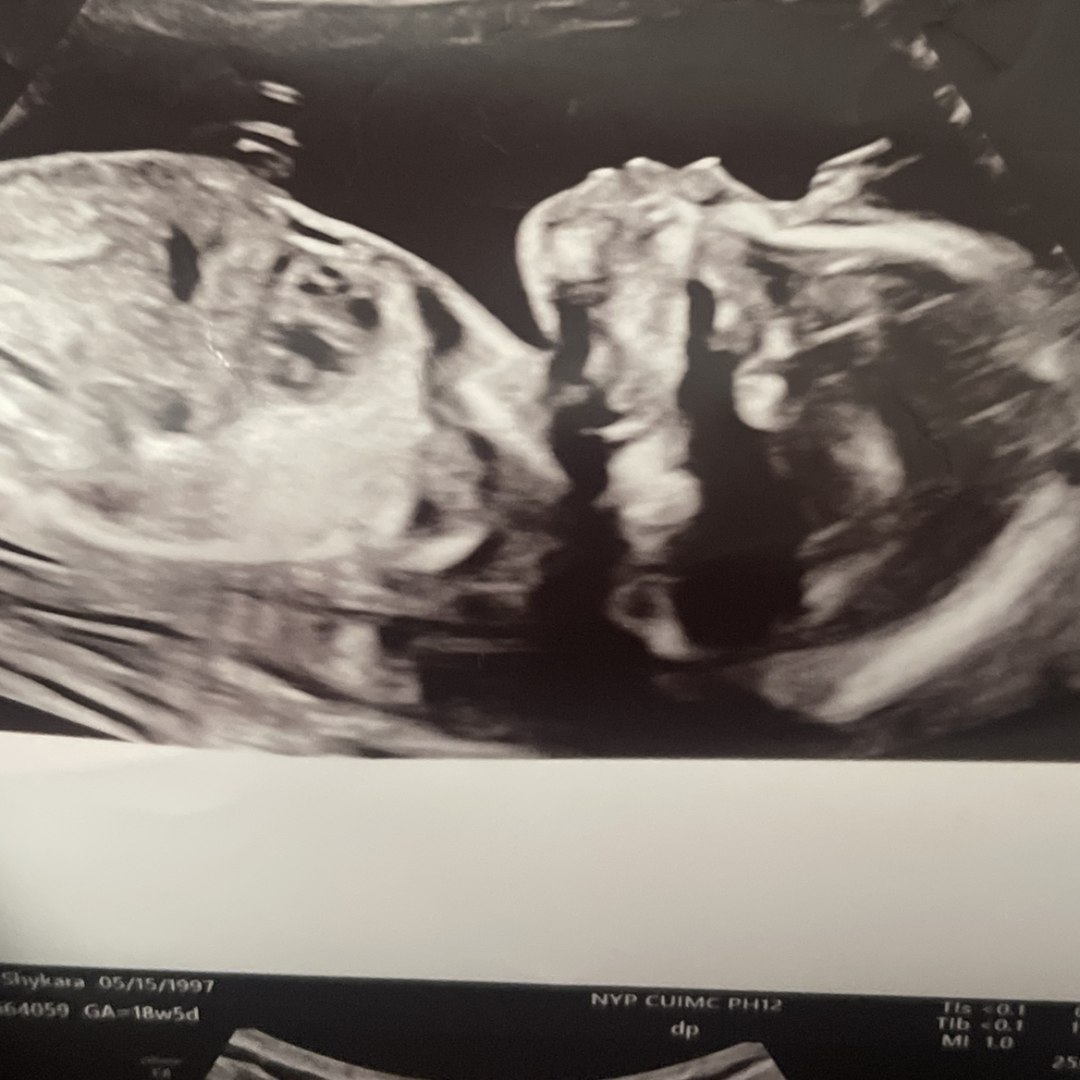 Photo shared by Kimberly for their Babylist baby registry.