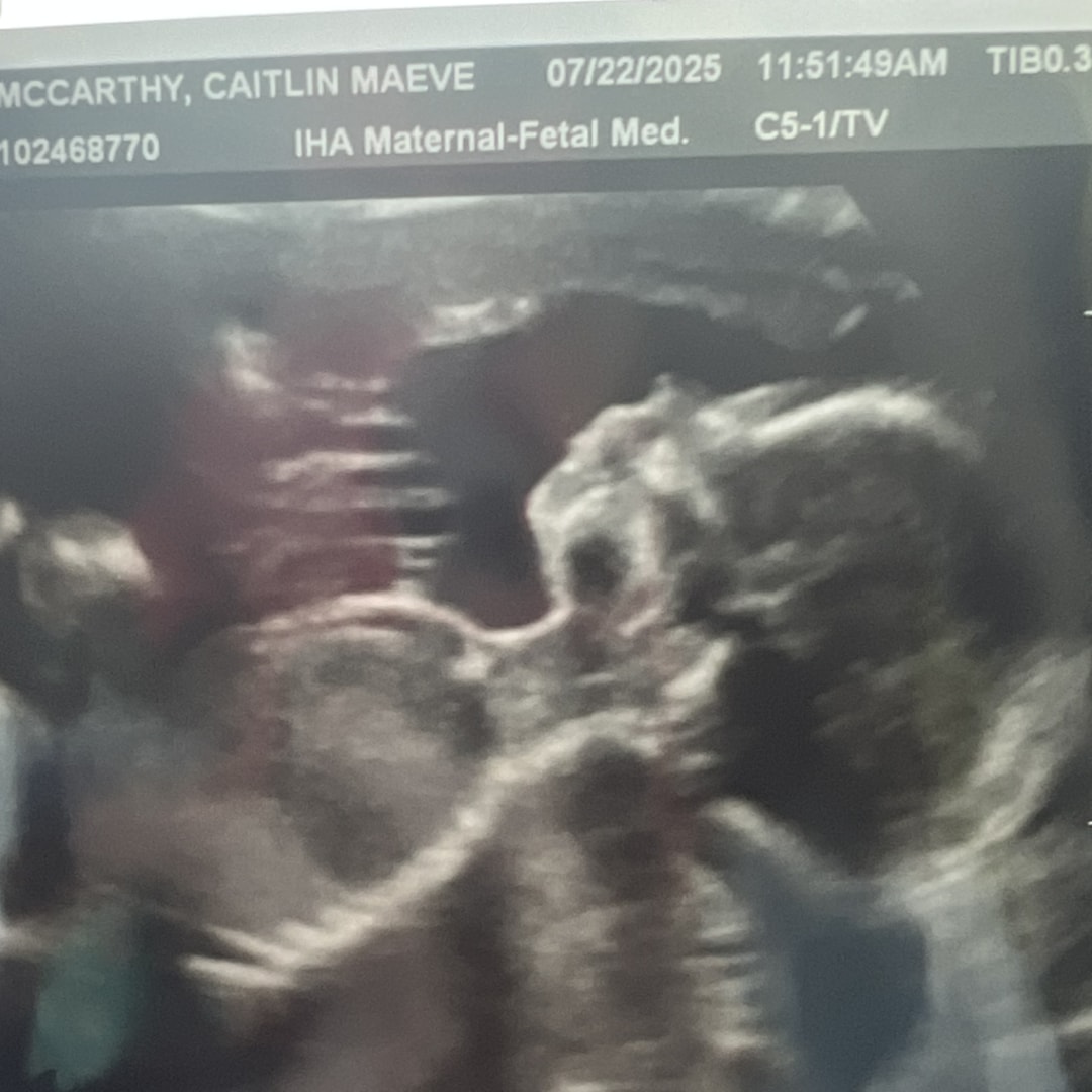 Photo shared by Caitlin for their Babylist baby registry.