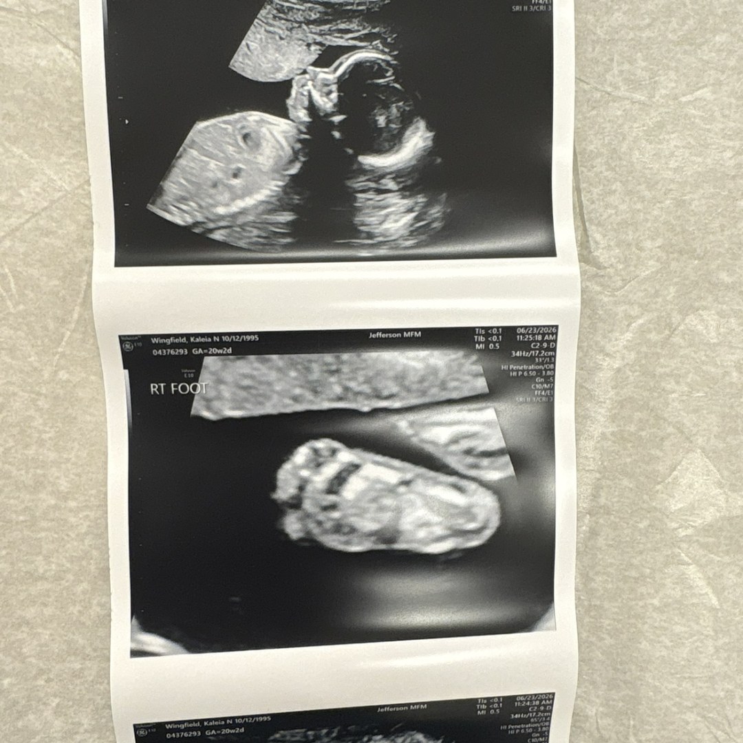 Photo shared by Kaleia for their Babylist baby registry.