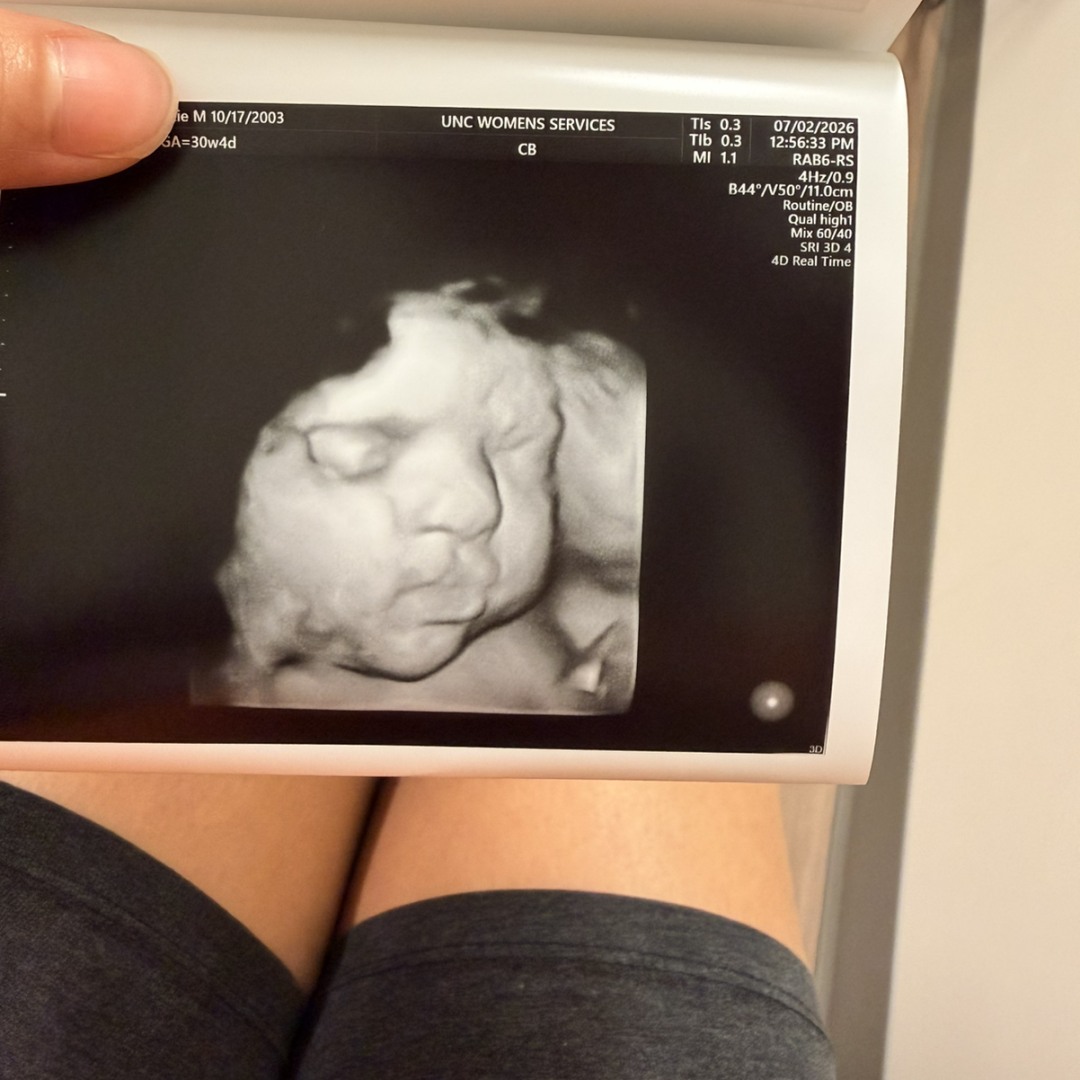 Photo shared by Mackenzie for their Babylist baby registry.