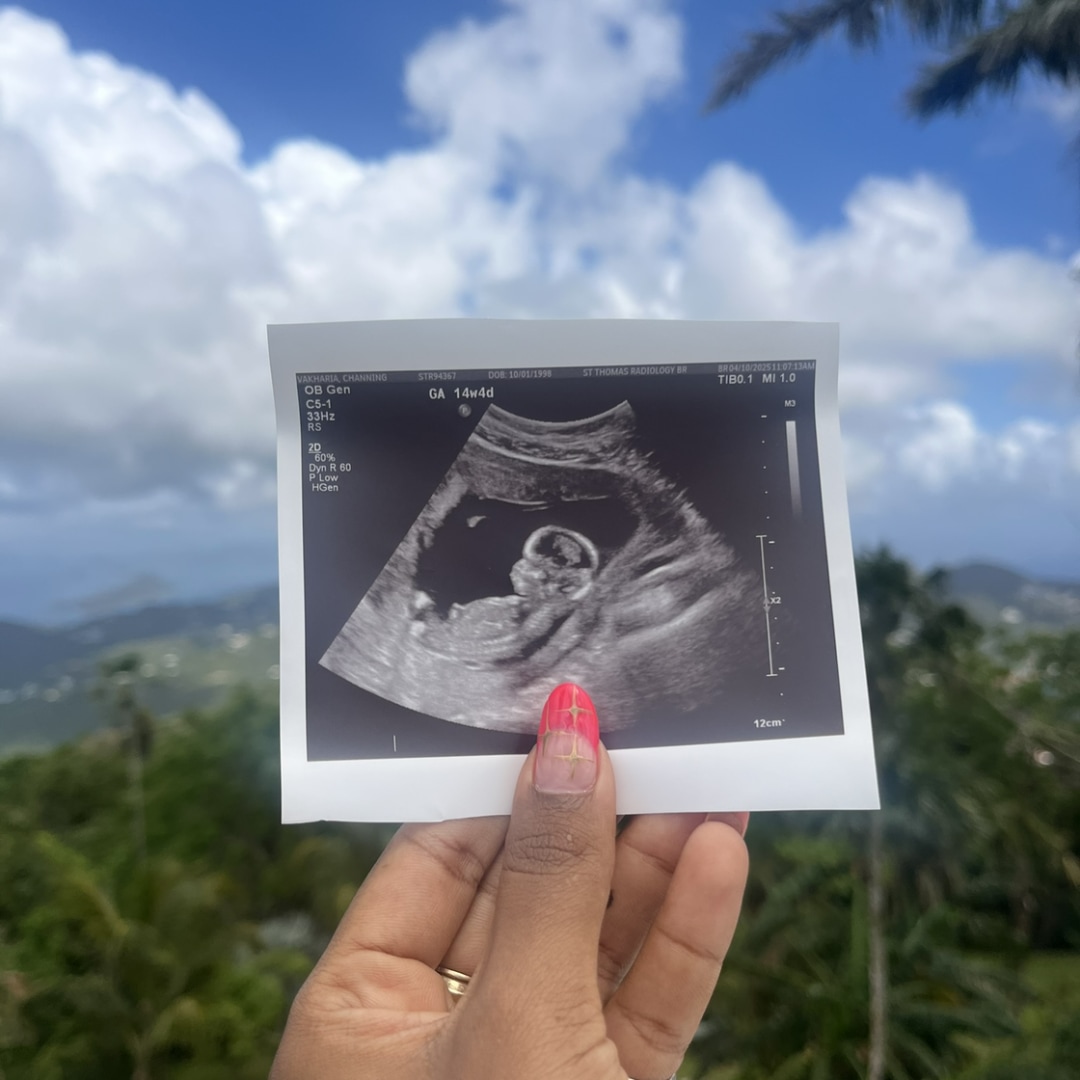 Photo shared by Channing for their Babylist baby registry.