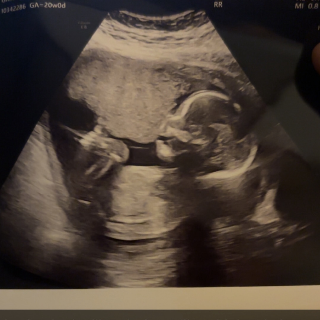 Photo shared by Courtney for their Babylist baby registry.