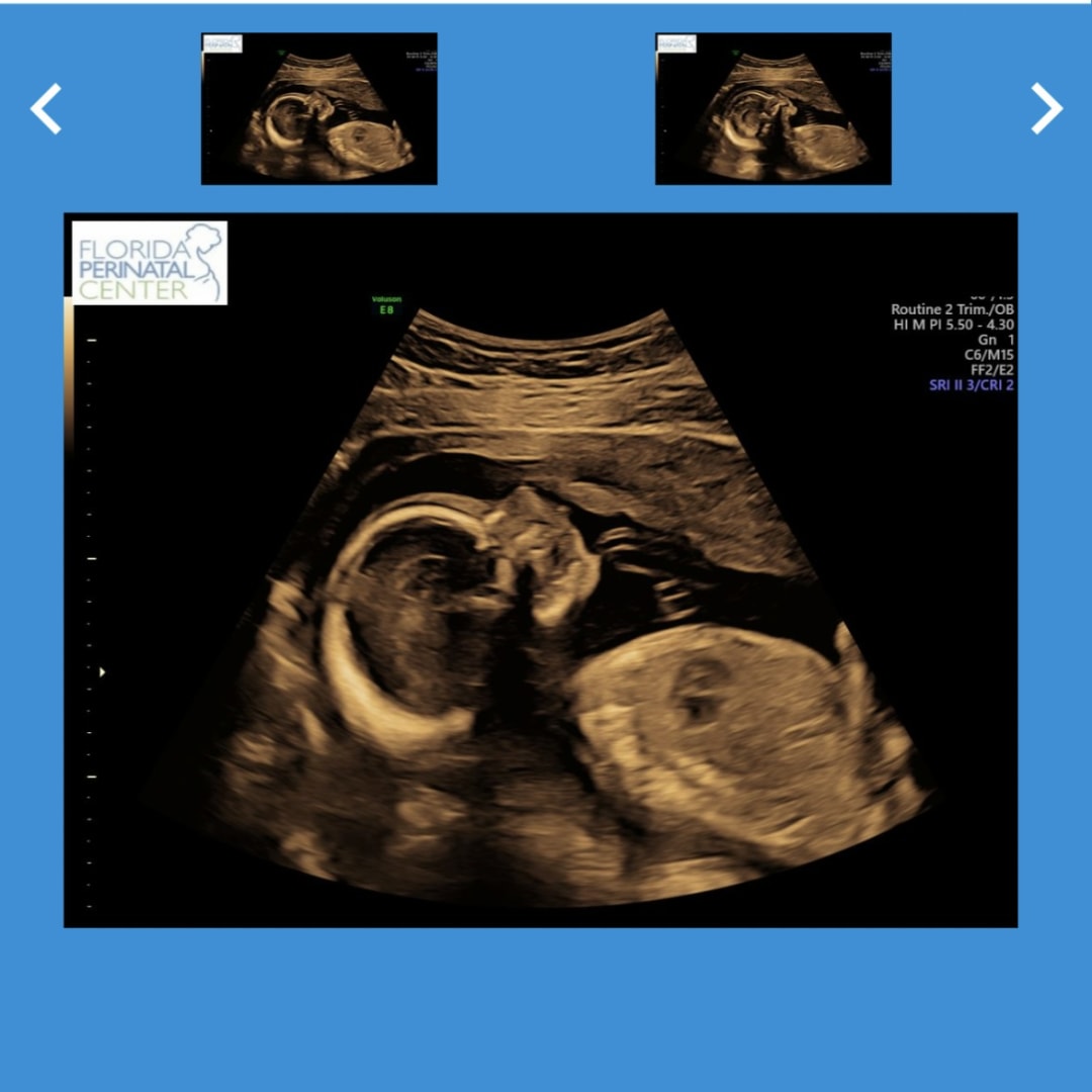 Photo shared by Lauren for their Babylist baby registry.