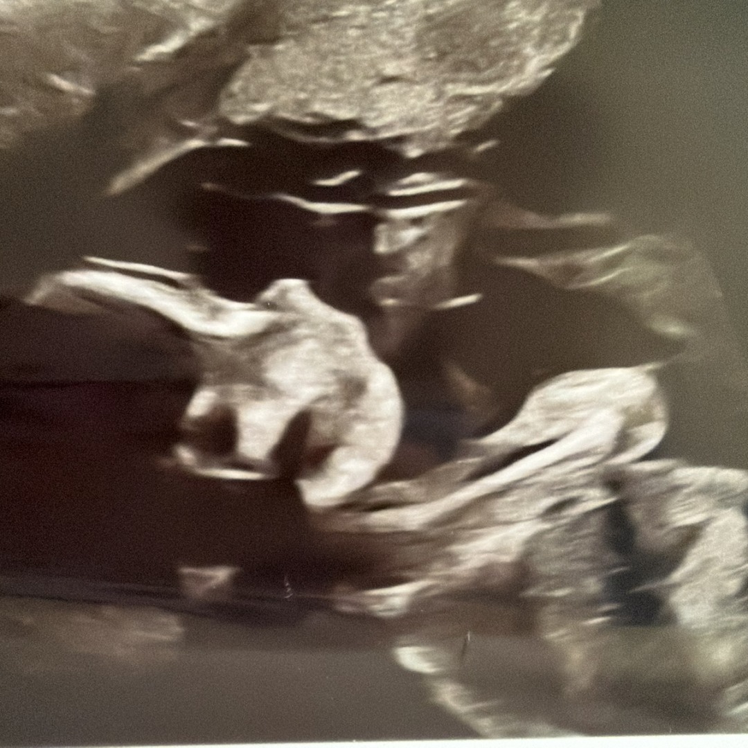 Photo shared by Katherine for their Babylist baby registry.