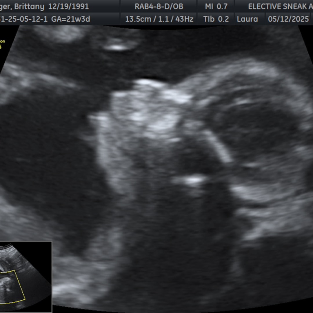 Photo shared by Brittany for their Babylist baby registry.