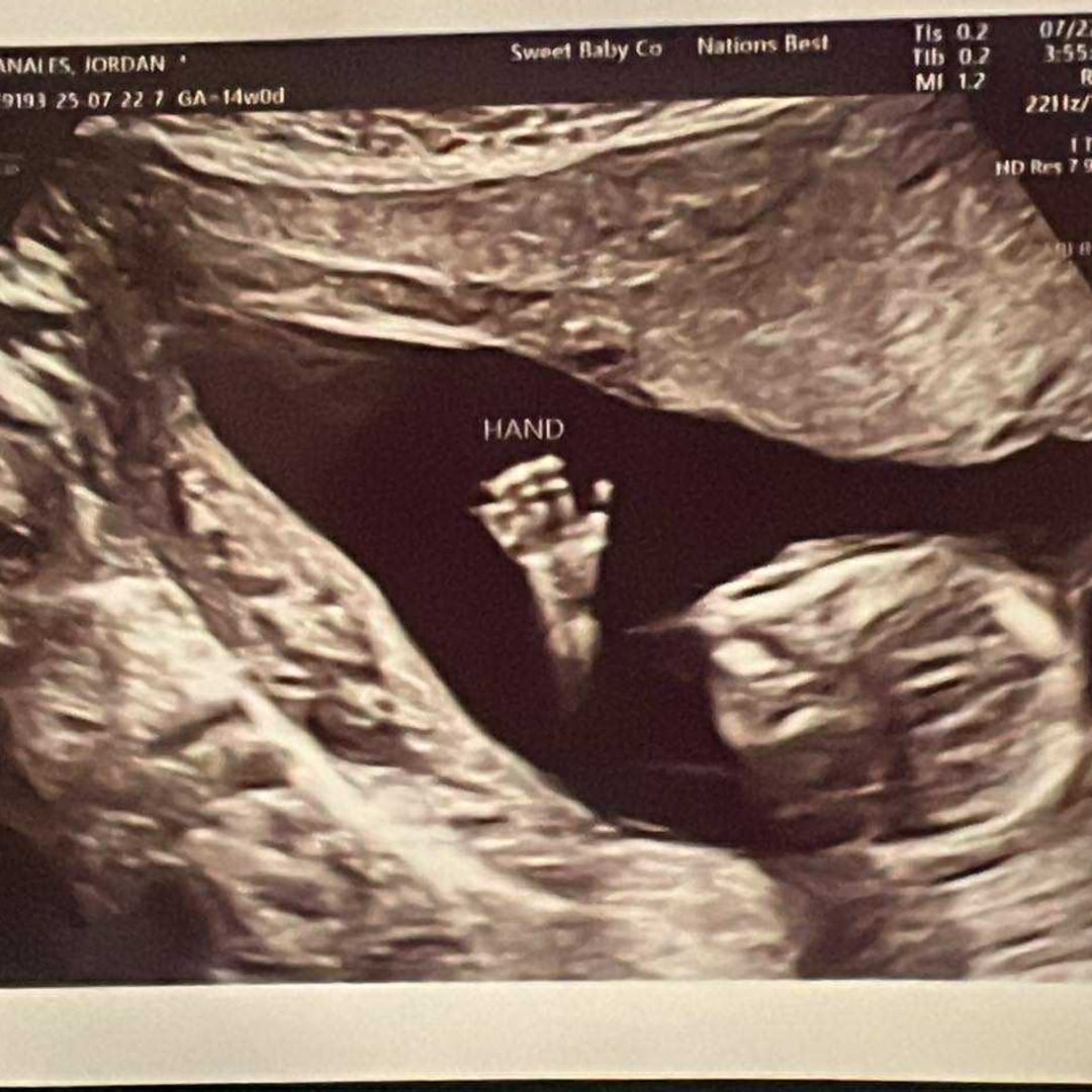 Photo shared by Jordan for their Babylist baby registry.