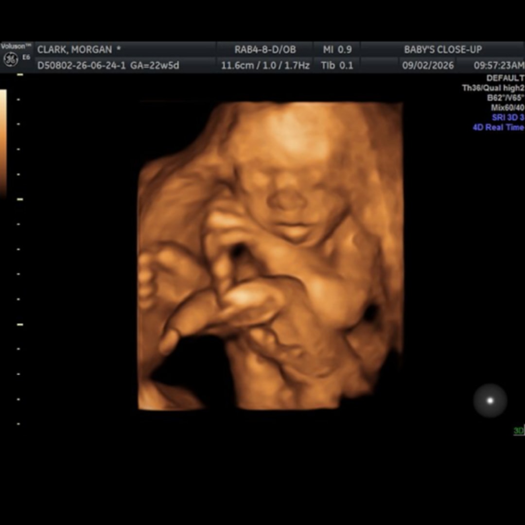 Photo shared by Morgan for their Babylist baby registry.