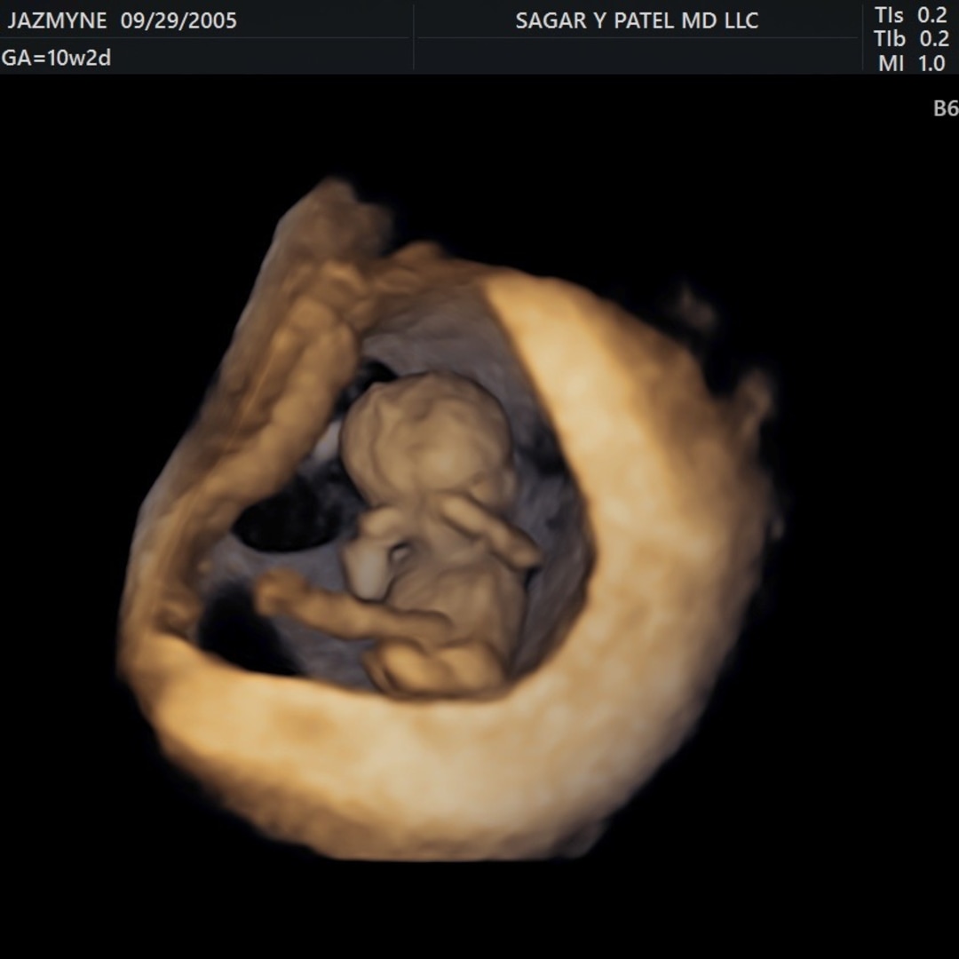 Photo shared by Jazmyne for their Babylist baby registry.