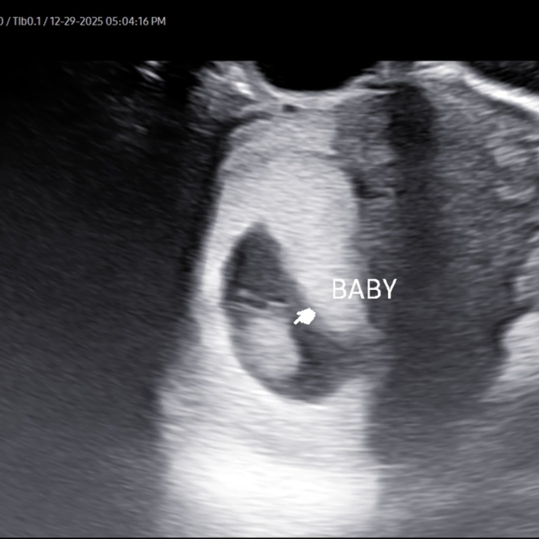 Photo shared by Courtney for their Babylist baby registry.