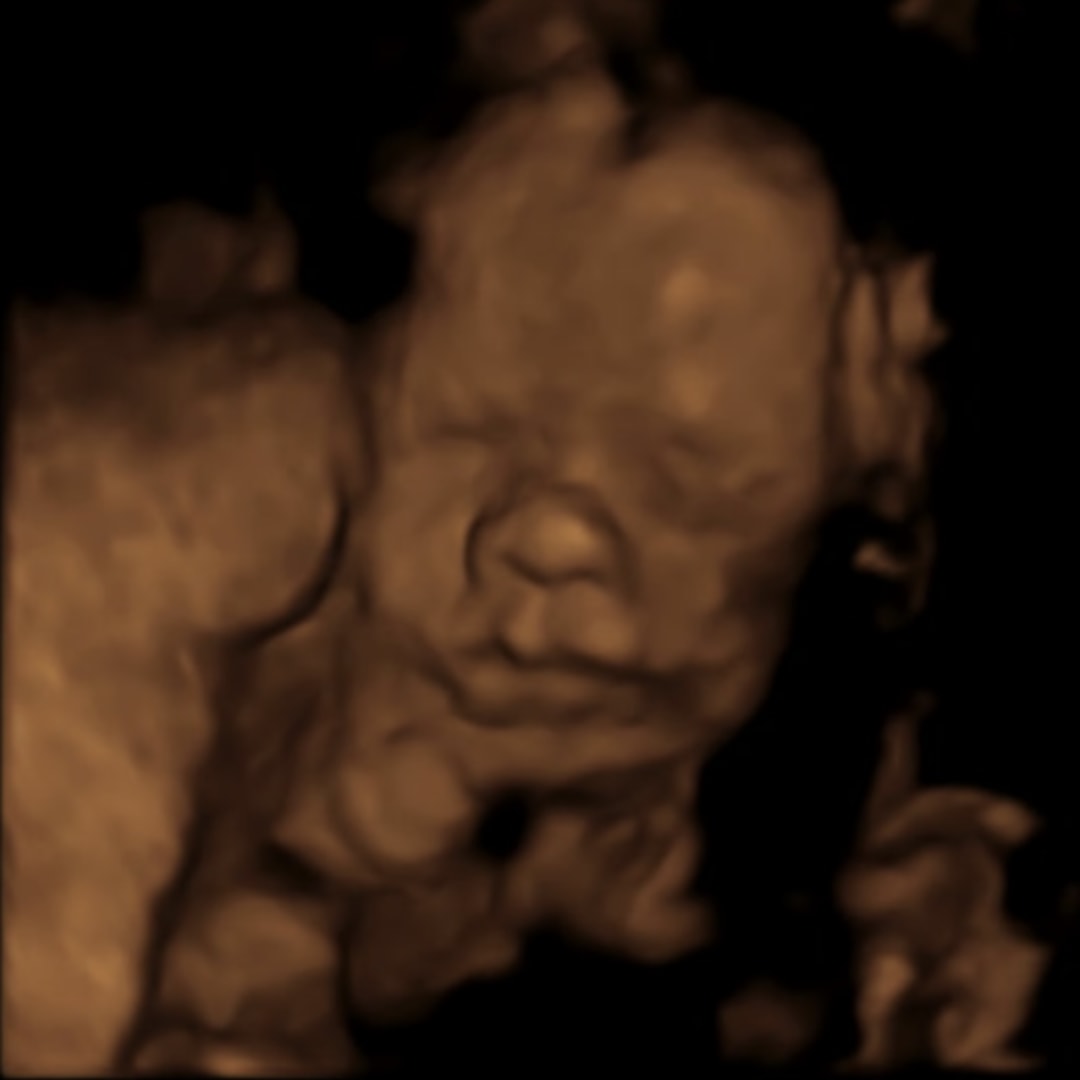 Photo shared by McKenzie for their Babylist baby registry.