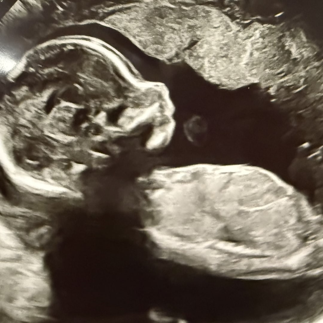 Photo shared by Breanna for their Babylist baby registry.
