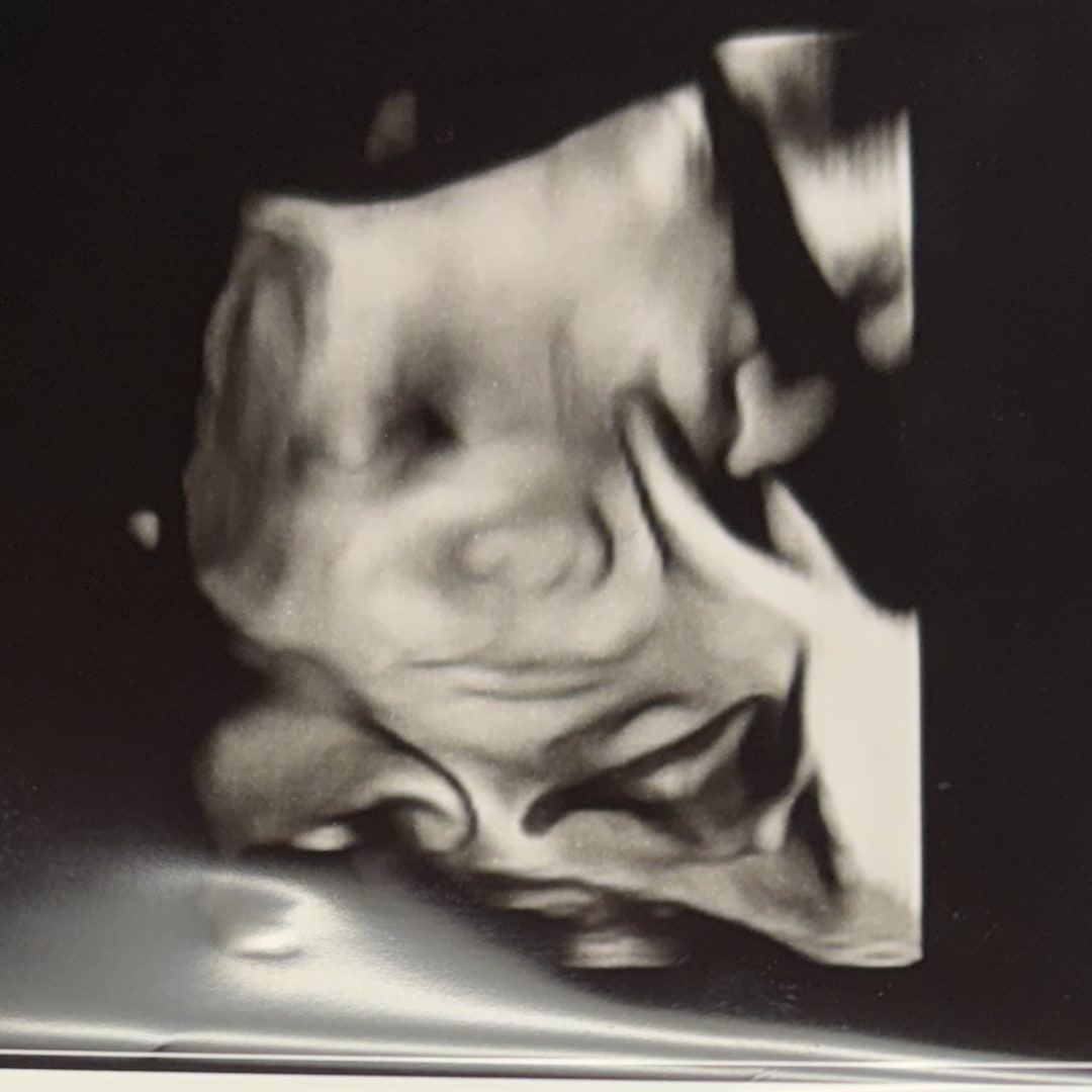 Photo shared by Michele for their Babylist baby registry.