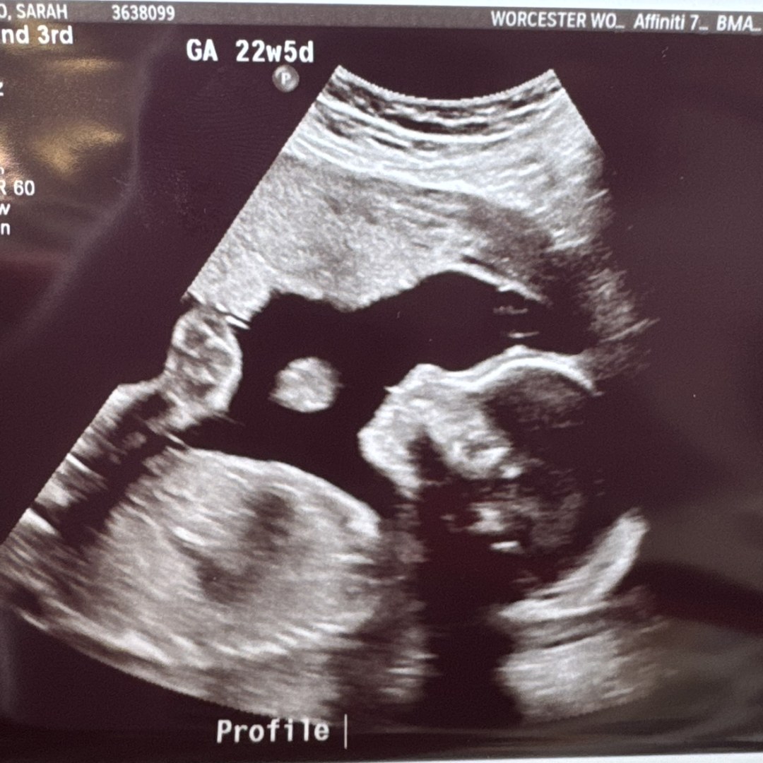 Photo shared by Sarah for their Babylist baby registry.