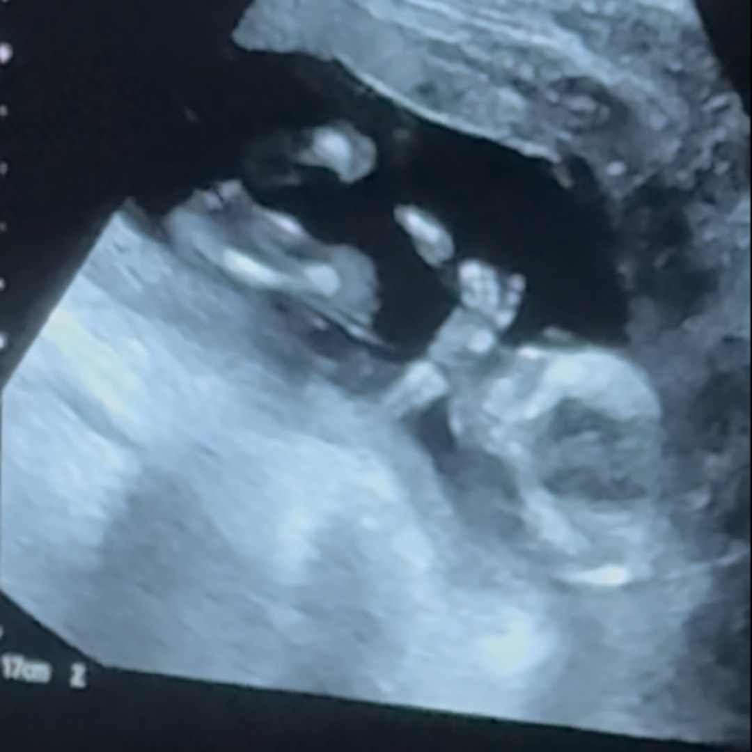 Photo shared by Daisy for their Babylist baby registry.