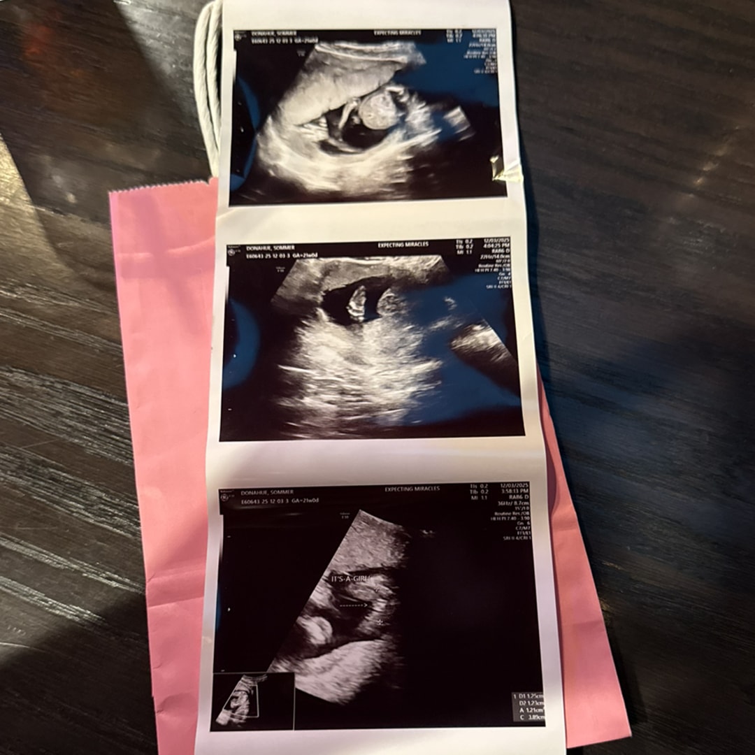 Photo shared by Sommer for their Babylist baby registry.