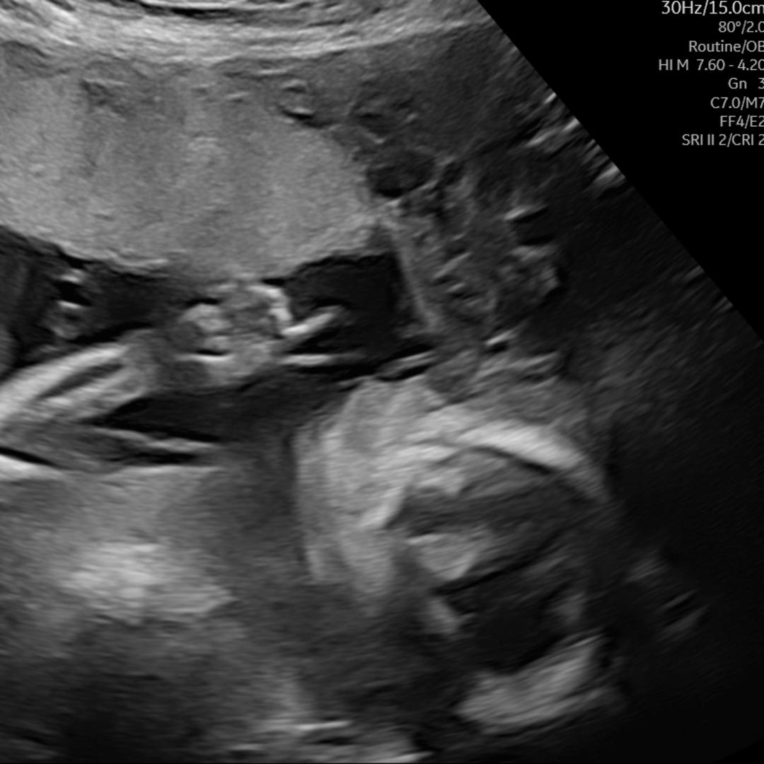 Photo shared by Grace for their Babylist baby registry.