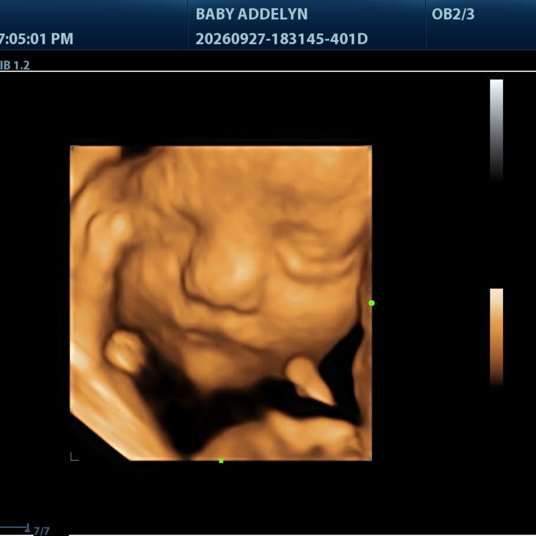 Photo shared by Brittany for their Babylist baby registry.