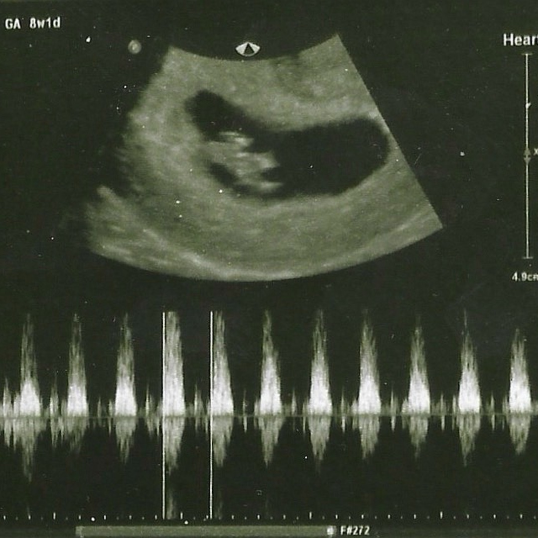 Photo shared by Kayla-Leigh for their Babylist baby registry.