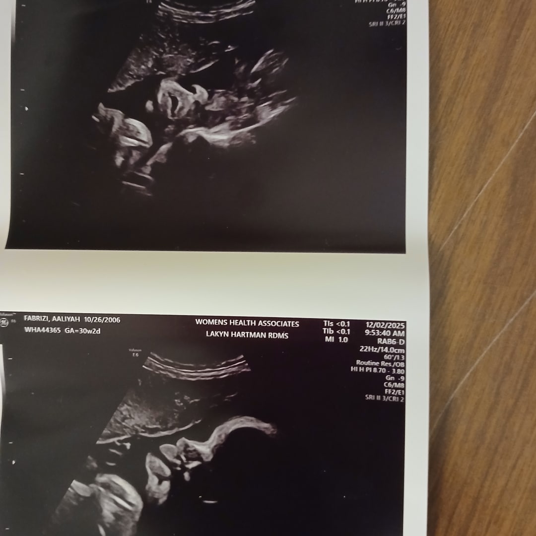 Photo shared by Aaliyah for their Babylist baby registry.