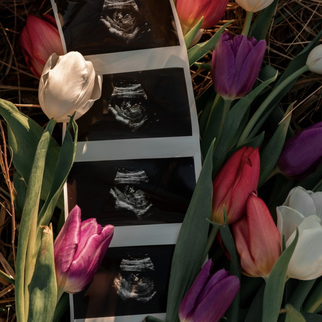 Photo shared by Whitney for their Babylist baby registry.