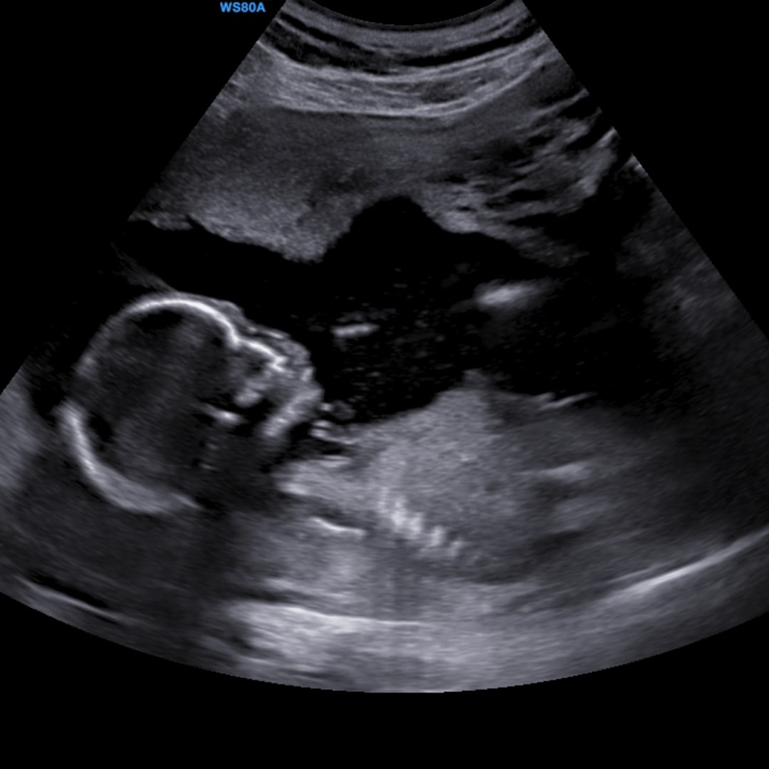 Photo shared by Adilya for their Babylist baby registry.