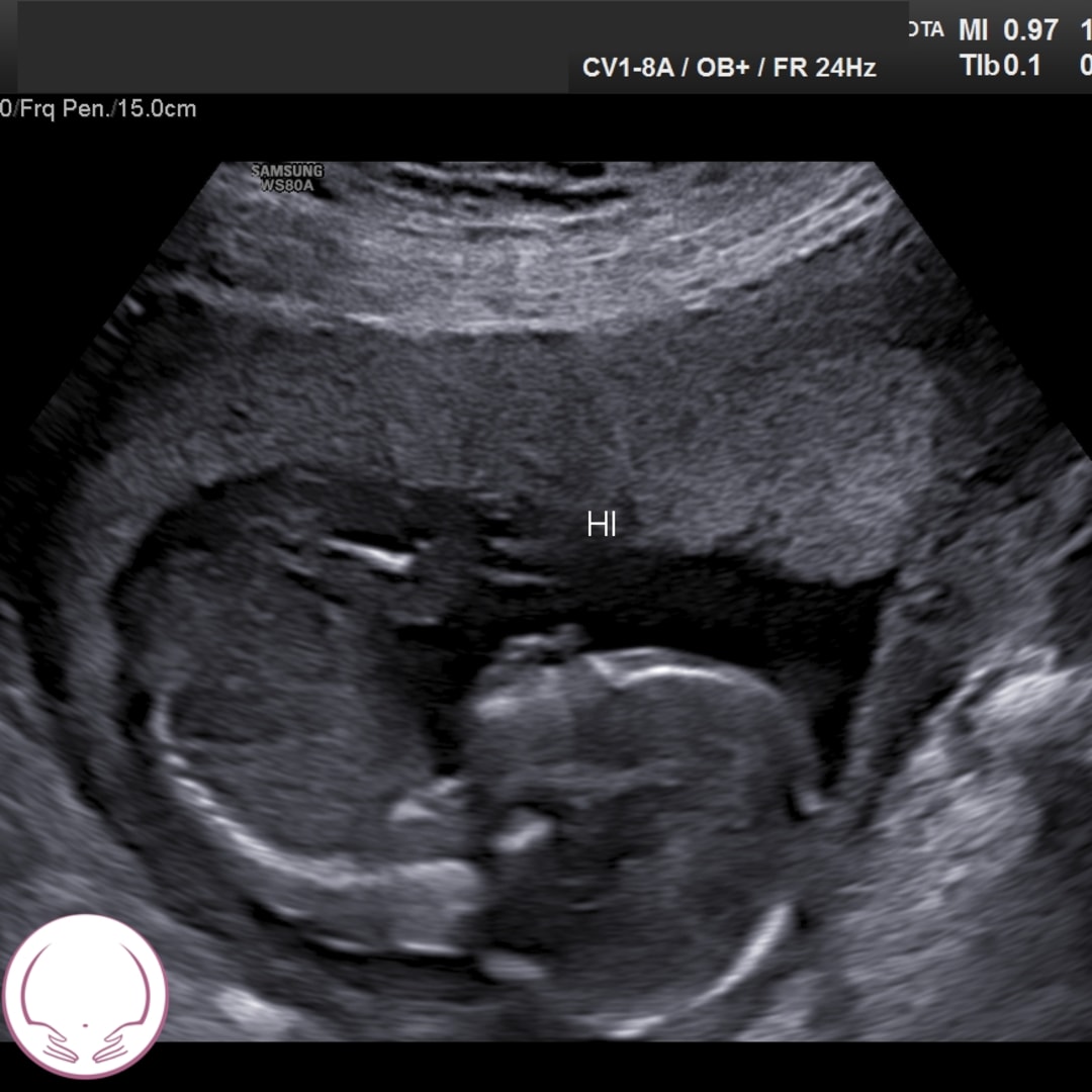 Photo shared by Nicole for their Babylist baby registry.