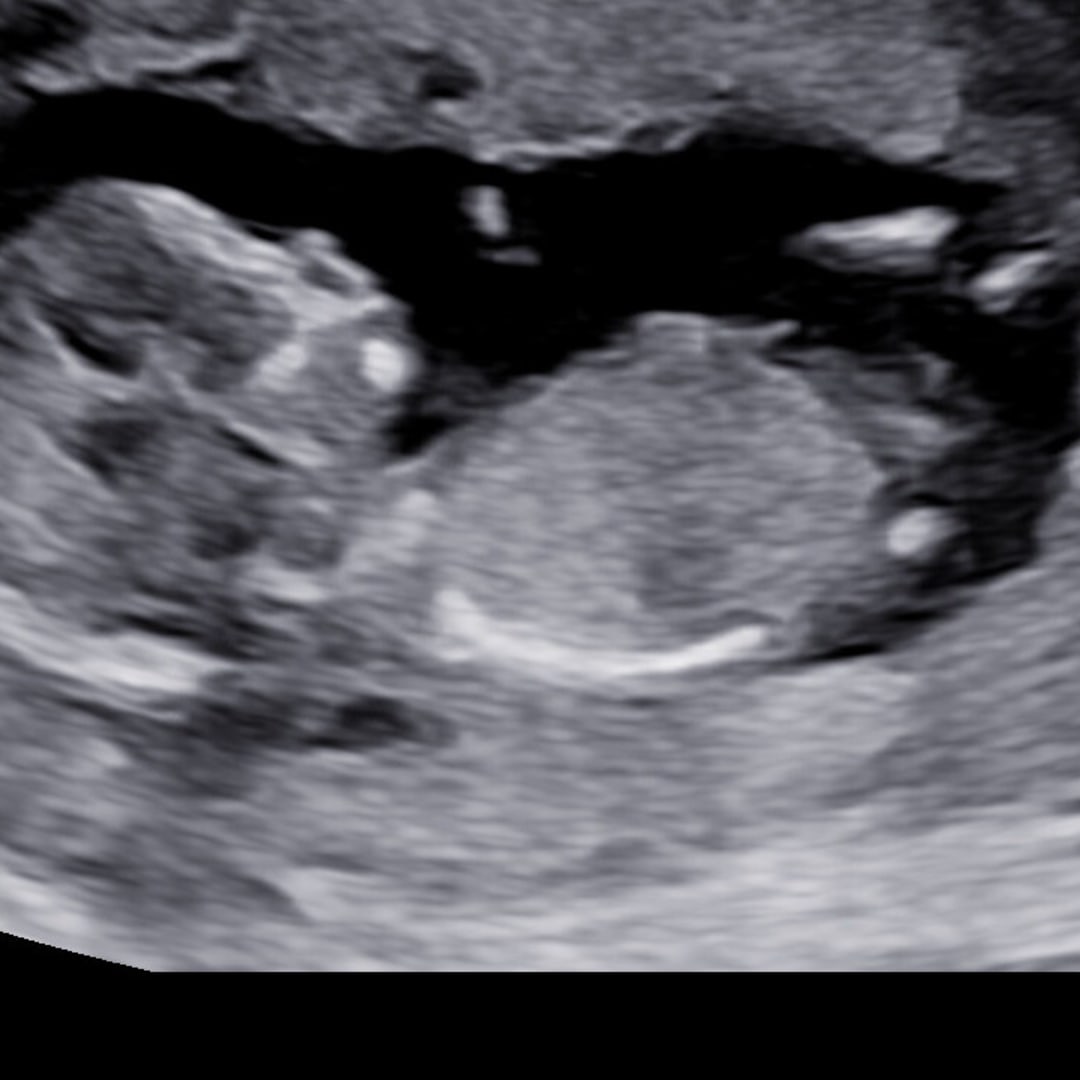 Photo shared by Casey for their Babylist baby registry.