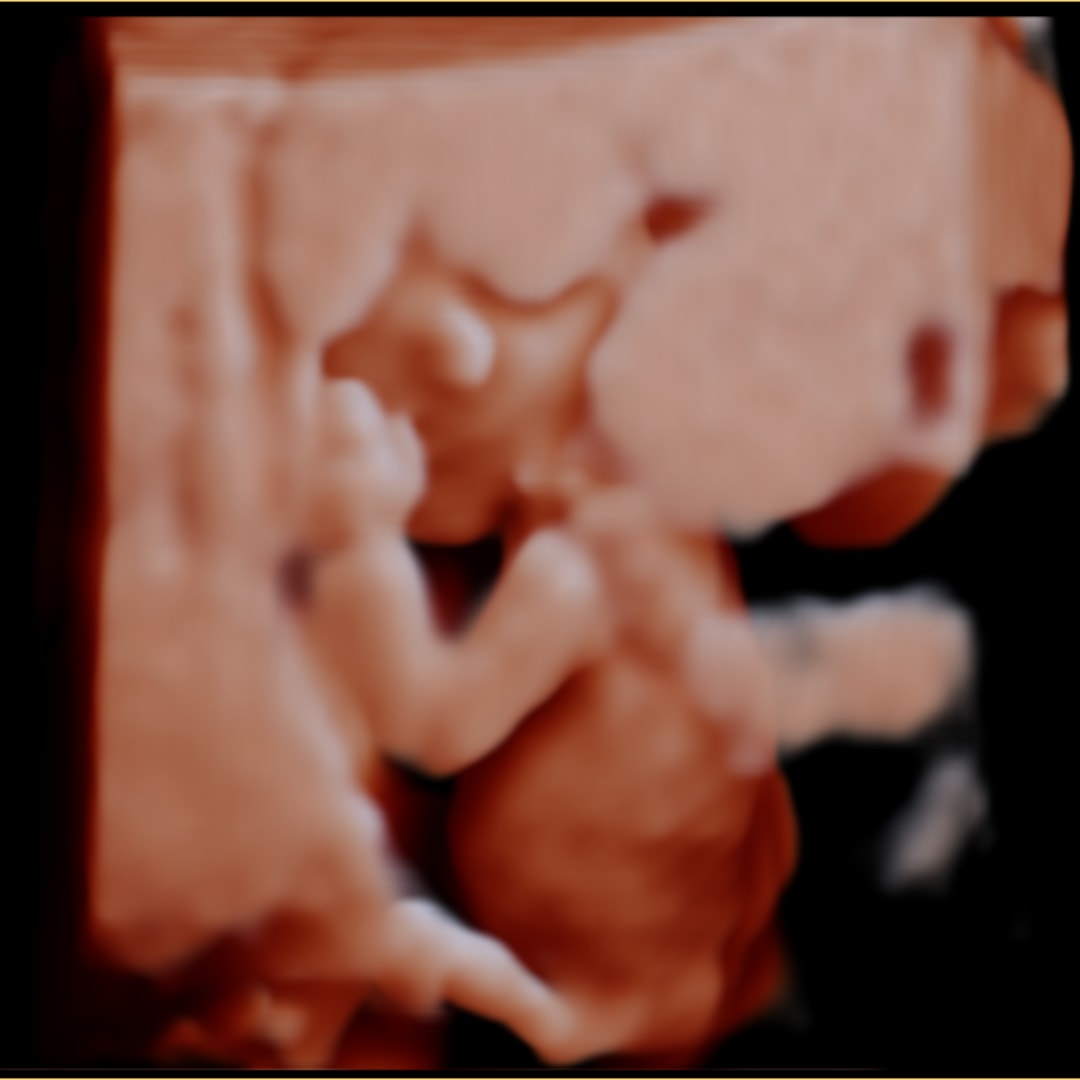 Photo shared by Alizé for their Babylist baby registry.