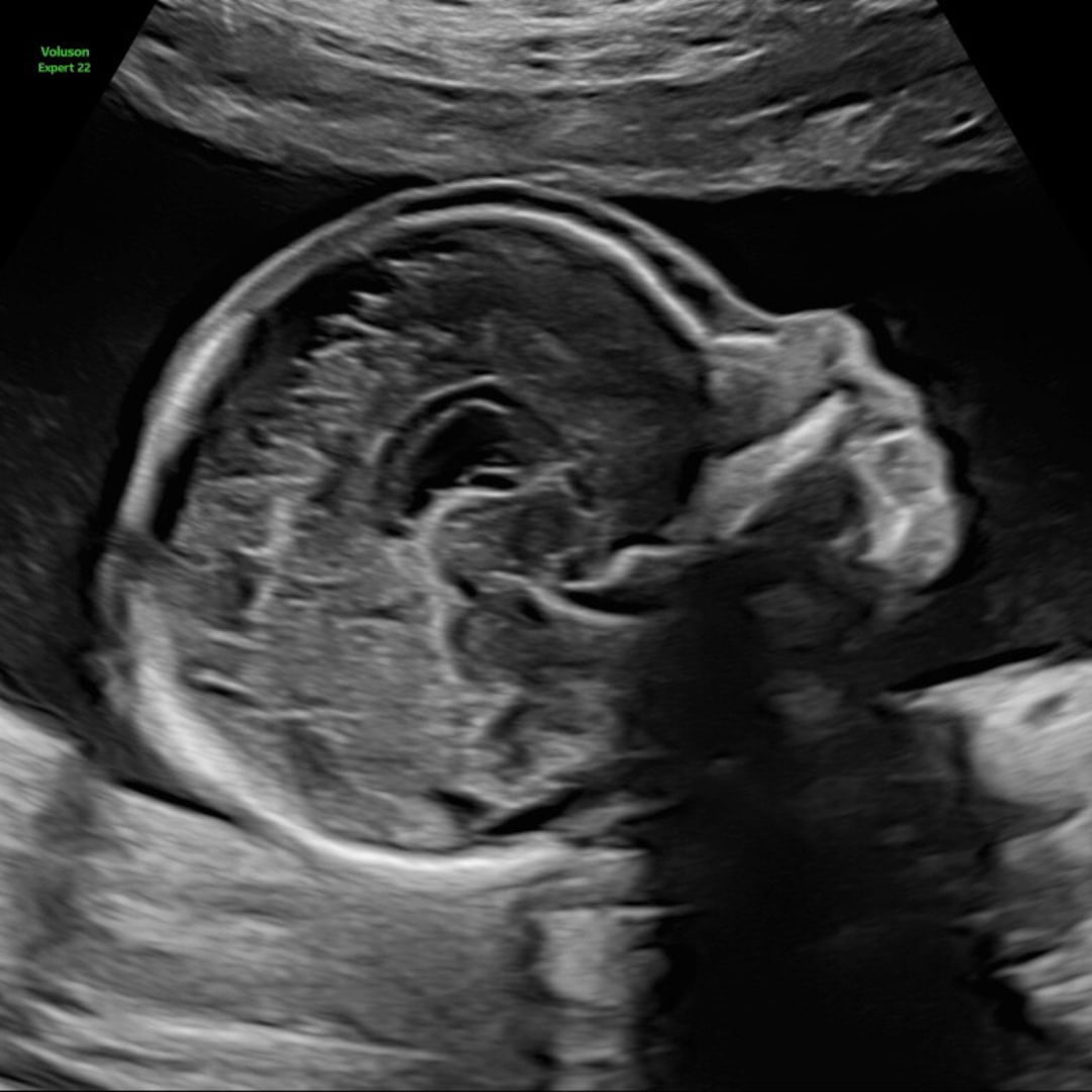 Photo shared by Brailey for their Babylist baby registry.