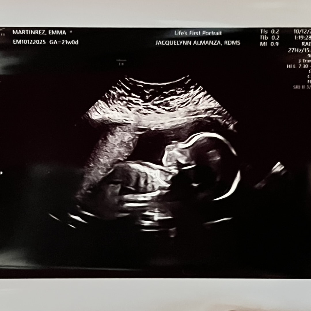 Photo shared by Emma for their Babylist baby registry.