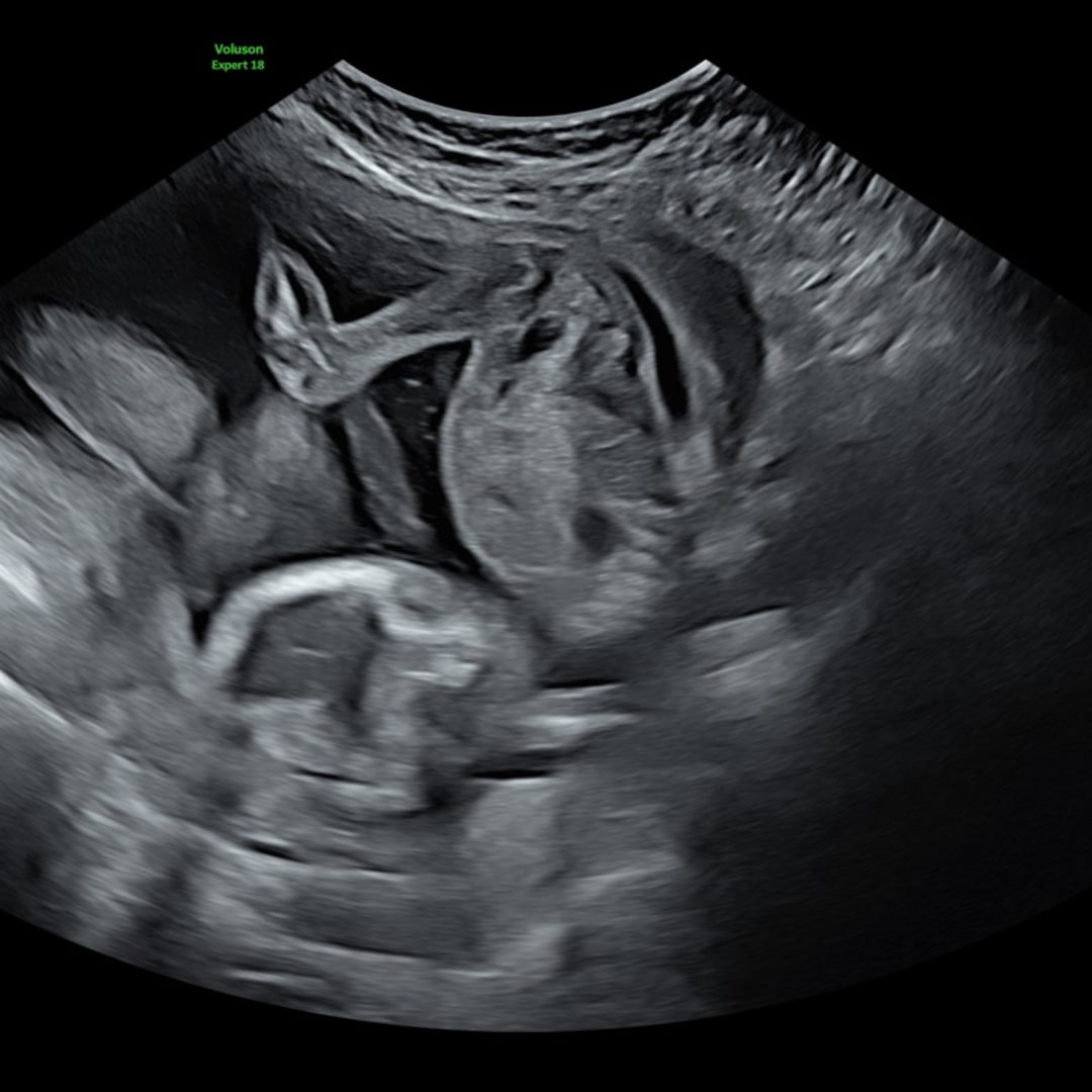 Photo shared by Aubrey for their Babylist baby registry.