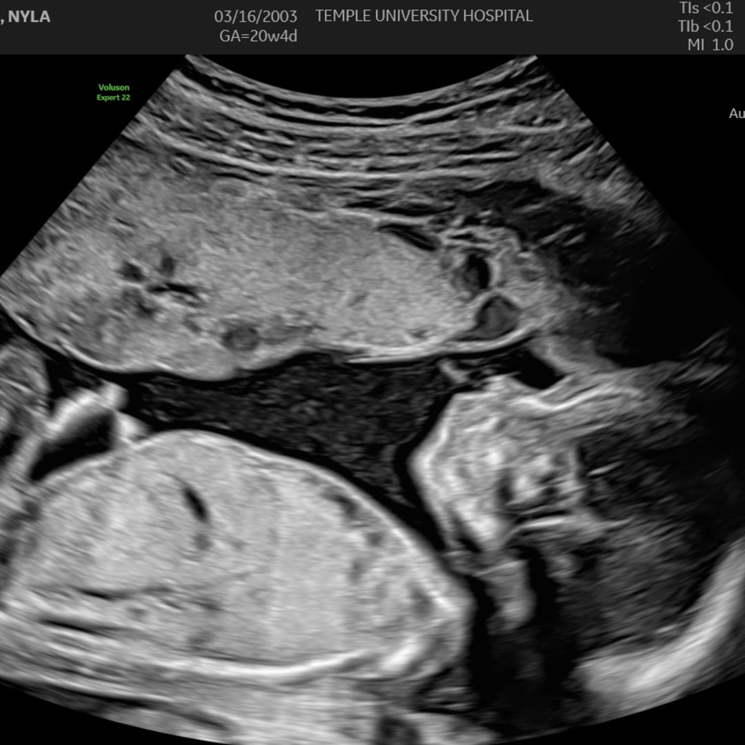 Photo shared by Nyla for their Babylist baby registry.